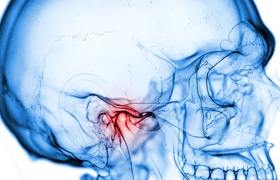 A digital image of a skull and the temporomandibular joints highlighted in red