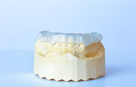 A mouth mold that has a mouthpiece designed to curb bruxism and minimize symptoms associated with TMJ Disorder