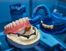 implant dentures in New Bedford