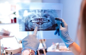 Dentist holding up and pointing to dental X-ray