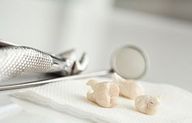 Three extracted teeth next to dental instruments