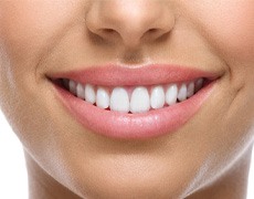 Veneers in New Bedford 