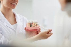 dental implant consultation