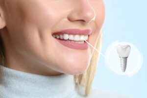 Woman with full smile after getting a dental implant
